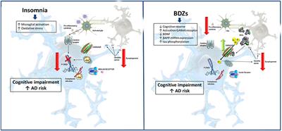 Benzodiazepines and Related Drugs as a Risk Factor in Alzheimer's Disease Dementia